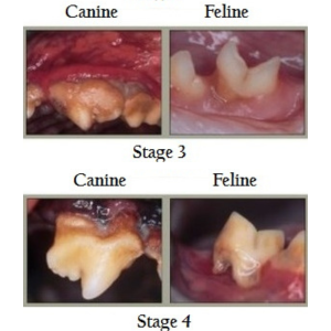 stages of dental disease